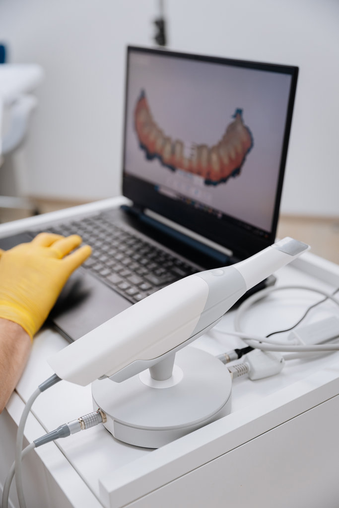 Advanced 3D dental scanner with digital teeth model displayed on a laptop in a dental clinic. High quality photo